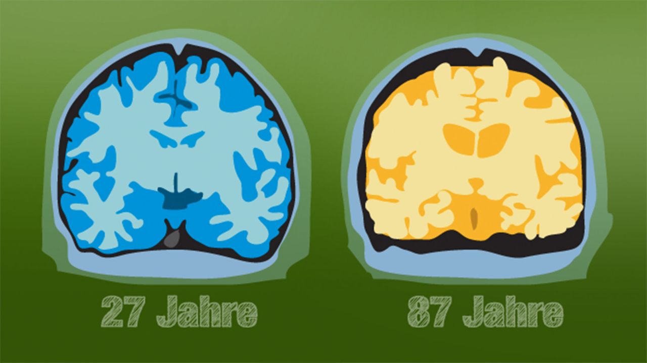 Wie Lange Lebt Das Gehirn Nach Dem Tod Weiter www.dasgehirn.info