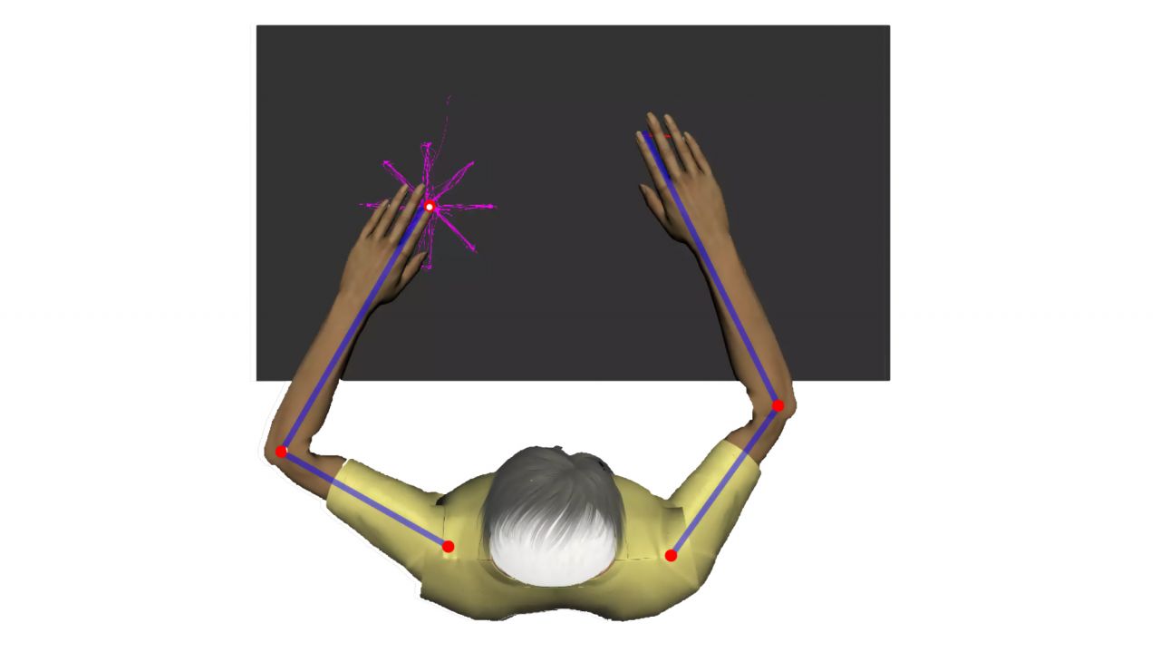 Erholung nach dem Hirninfarkt | dasGehirn.info - der Kosmos im Kopf