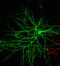 Dornentragende Neurone im Cortex. © Kaushalya, Kuner und Kuner, Uni Heidelberg