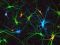 Vernetzte Neuronen im Hippocampus