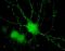 Kommunikation der Neuronen über Synapsenendknöpfe