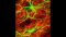 Neuronale Kultur mit 80 Prozent hemmenden (rot) and 20 Prozent erregenden (grün) Neuronen
