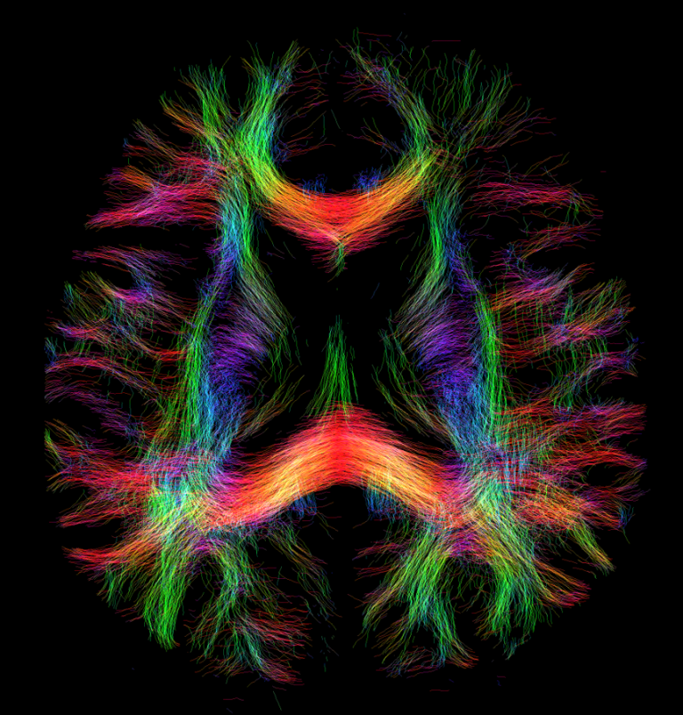 "Data courtesy of SFB1436 - project no. 425899996. Principal investigators: Prof. Dr. Oliver Speck, Jun.-Prof. Dr. Hendrik Mattern, Dr. David Berron. Acquisition and sequence design by Dr. Yi-Hang Tung.  Visualization and processing by Dr. Daniel Uher.  Scanner: Siemens MAGNETOM 7T Terra.X Impulse Edition, Department Biomedical Magnetic Resonance (BMMR), Otto-von-Guericke-Universität Magdeburg."