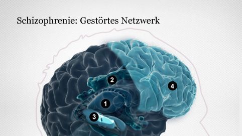Betroffene Hirnregionen bei Schizophrenie