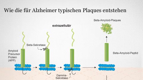 Entstehung von Alzheimer-Plaques
