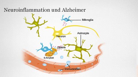 Blut-Hirn-Schranke und Neuroinflammation
