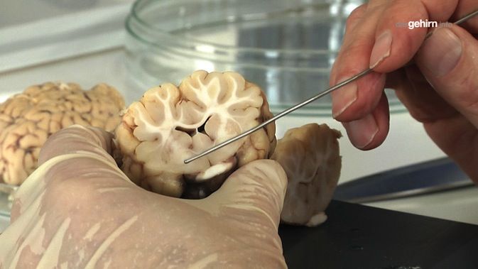Anatomie Dasgehirn Info Der Kosmos Im Kopf