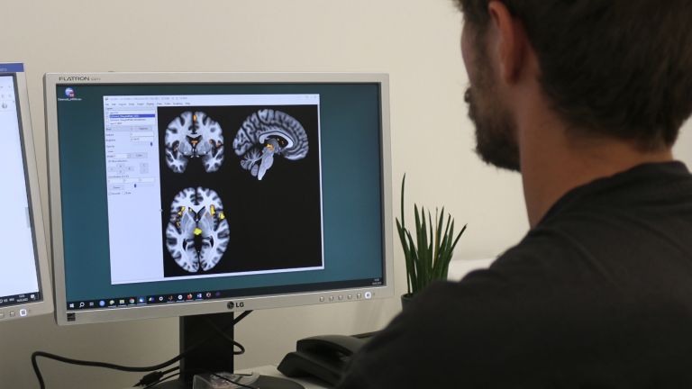 Anhand von Daten aus Kernspintomografien konnten die Forscher die Gehirne von gesunden und an Fibromyalgie erkrankten Probandinnen vergleichen.
