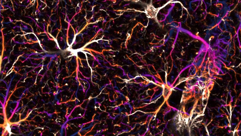 Netzwerk von Astrozyten im Hippocampus einer Maus unter dem Fluoreszenzmikroskop. 