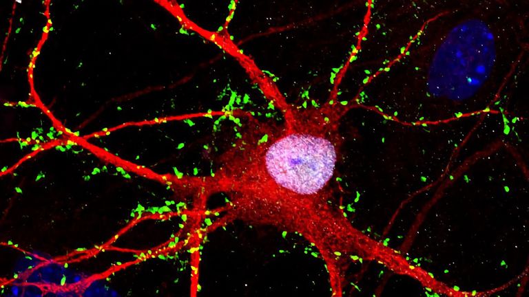 In der Kulturschale aus Stammzellen programmierte menschliche Gehirnzellen (rot, grün)