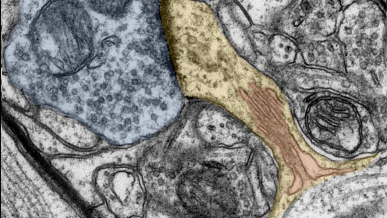 Mit Hilfe von elektronenmikroskopischen Bildern machen die Forschenden die dendritischen Dornen (gelb) mit ihrem Dornenapparat (rot) sowie die Synapsen-Endknöpfchen (blau) sichtbar. 