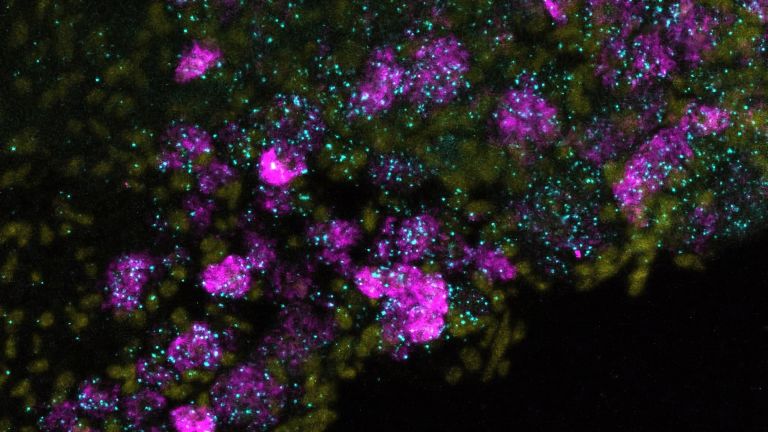 Nervenzellen in der Maus: Der neue Ionenkanal Elkin1 (cyan), der für die Wahrnehmung von Berührungen wichtig ist, Zellkerne (gelb) und der bereits bekannte Ionenkanal Piezo2 (magenta).