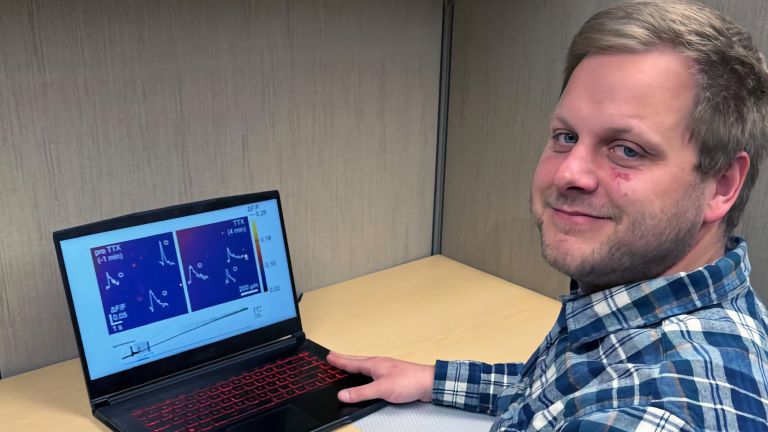 Erstautor Tim Ziebarth zeigt auf dem Bildschirm die untypischen Glutamatfreisetzungsereignisse, die mithilfe eines Fluoreszenzsensors sichtbar gemacht wurden.