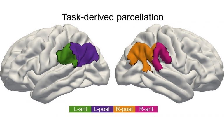 Für Sprachverständnis ist der vordere Teil des IPL in der linken Hirnhälfte von Bedeutung (grün), bei Aufmerksamkeit ist es der vordere Teil auf der rechten Hirnseite (pink). Geht es um soziale Kompetenzen, treten die hinteren IPL-Teile in beiden Hirnhälften gemeinsam in Aktion (orange, violett).