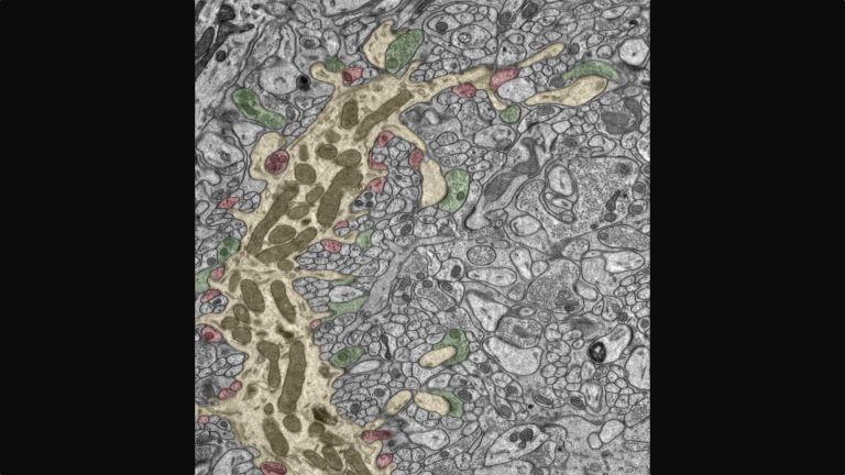 Elektronenmikroskopische Aufnahme von Neuronen im Kleinhirn. Dieser Schnitt durch die Zellen des Kleinhirns zeigt einen dendritischen Zweig einer Purkinje-Zelle und ihre Seitenarme (gelb), die mehrere erregende (grün) und hemmende (rot) Signale erhalten.