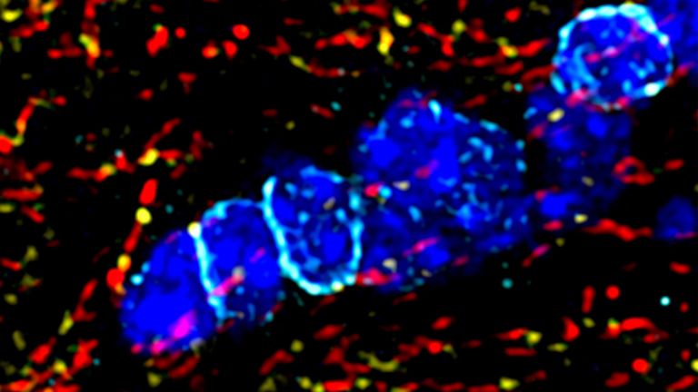 Die Fluoreszenzaufnahme zeigt die Kolokalisation von Kir4.1-Kanälen (türkis) auf Oligodendrozyten (blau) und Kv7-Kanälen (gelb) auf Axonen von Nervenzellen. Die Kv7-Kanäle sind dabei von spezifischen Abschnitten der Axone umrandet (rot).