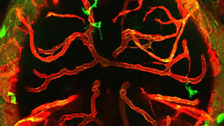 Interaktionen zwischen Makrophagen/Mikroglia und Hirngefäßen führen zu Gefäßrückbildung und Zelltod im Gehirn. Das Bild zeigt das Gehirn eines Zebrafisches mit Makrophagen/Mikroglia in grün und Blutgefäßen in rot.