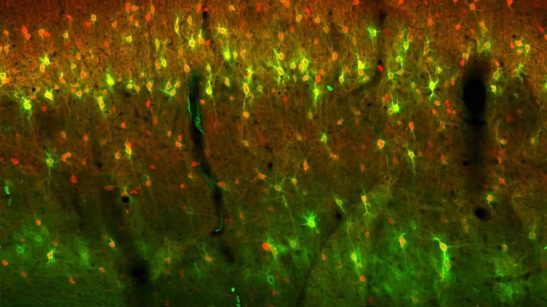 Im histologischen Hirnschnitt wurden Teile der extrazellulären Matrix (grün), die die Nervenzellen (rot) umgibt, angefärbt und unter dem Mikroskop analysiert.