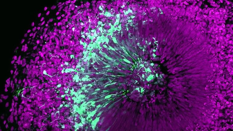 Mikroskopische Aufnahme eines menschlichen Gehirn-Organoids