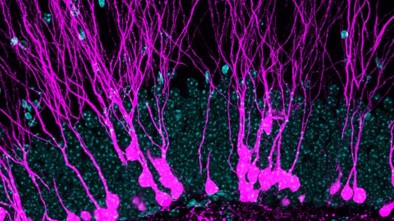 Das Bild zeigt neue Neuronen (magenta) im Hippocampus einer erwachsenen Maus. Zellkerne sind cyan gefärbt. Die langen Dendriten sind der wichtige Orte, an denen Mechanismen der Plastizität und des Wettbewerbs um das Zellüberleben stattfinden.