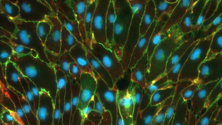 Blut-Hirn-Schranke: Menschliche aus Stammzellen abgeleitete Endothelzellen