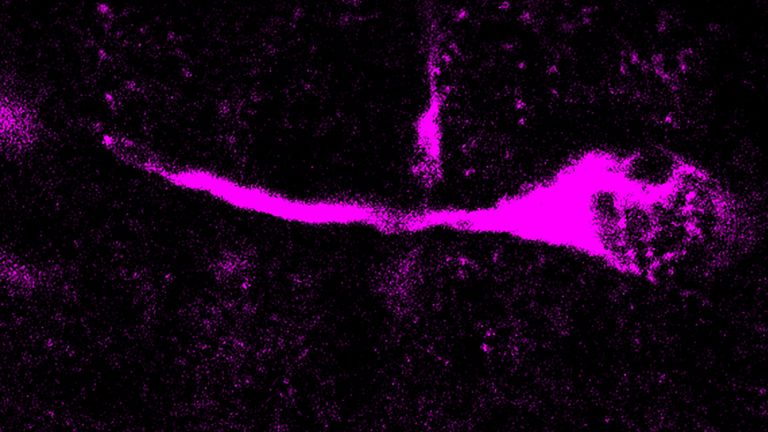 Mikroskopische Aufnahme einer sich teilenden basalen radialen Gliazelle, einer Vorläuferzelle, aus der während der Gehirnentwicklung Neuronen entstehen. Modernes menschliches TKTL1, aber nicht das des Neandertalers, erhöht die Anzahl der basalen radialen Gliazellen und Neuronen.