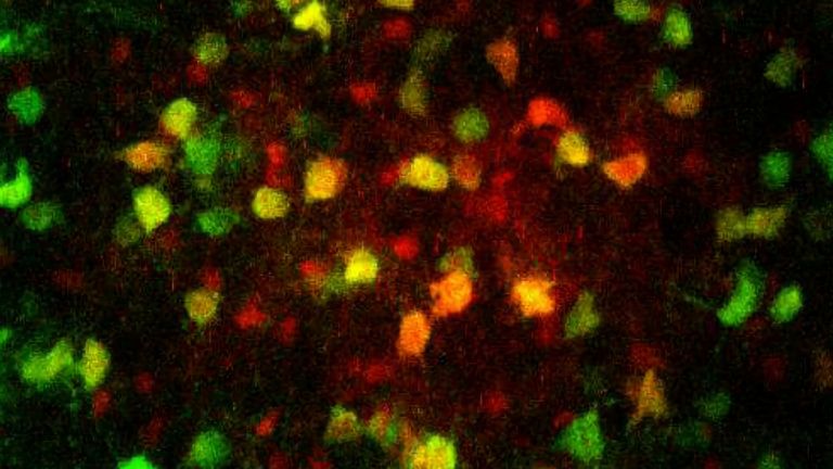 Wird ein Astrozyt im Thalamus mit Farbstoff gefüllt, diffundiert dieser in benachbarte Zellen des Netzwerks (rot). Darunter sind viele Oligodendrozyten (grün), wie die Überlagerung (gelb) zeigt.