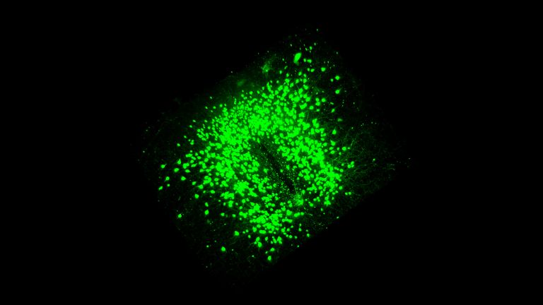 3D-Darstellung von POMC-Neuronen im Hypothalamus