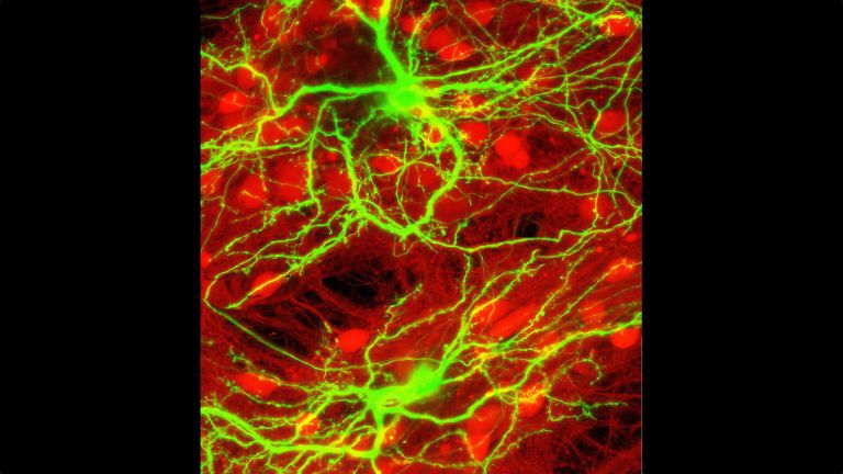 Neuronale Kultur mit 80 Prozent hemmenden (rot) and 20 Prozent erregenden (grün) Neuronen