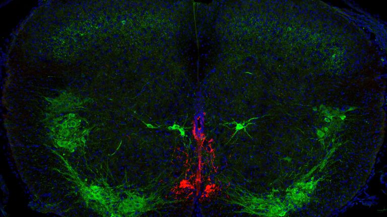 Ein Querschnitt durch den Zentralkanal des Rückenmarks einer Maus. In Rot sind die CSF-kontaktierenden Zellen zu sehen, Motoneuronen sowie eine andere Zellpopulation in der Nähe des Kanals sind grün angefärbt.