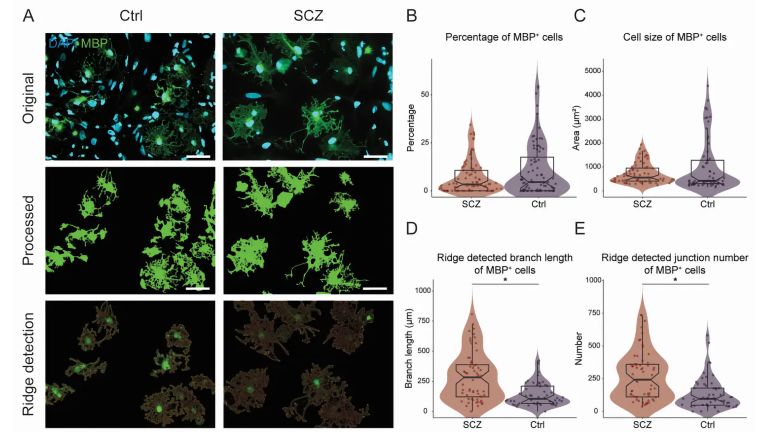 Die Bildanalyse zeigt weder eine Veränderung der Gesamtmenge noch morphologische Veränderungen der O4+-Oligodendrozyten-Vorläuferzellen bei SCZ.