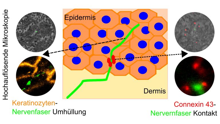 Mit Hilfe hochauflösender Mikroskopie konnte die AG von Prof. Nurcan Üçeyler am UKW zeigen, dass Nervenfasern in der obersten Hautschicht von Hautzellen, Keratinozyten, umhüllt sind und eine Signalübertragung über das Protein Connexin-43 stattfindet.