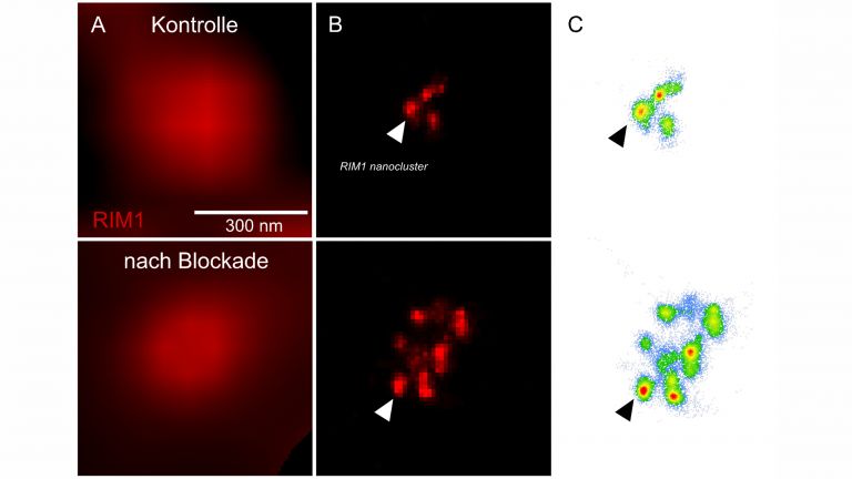 Die Plastizität neuronaler Kommunikation, hervorgerufen durch eine 48-stündige Blockade neuronaler Aktivität, korreliert mit der Anzahl der RIM-Molekülcluster in der aktiven Zone. Spalte A ist aufgenommen mit Weitfeldbeleuchtung; B mit dStorm-Mikroskopie