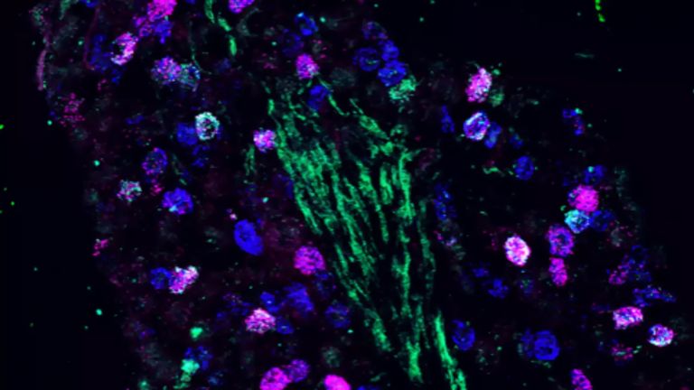 Fluoreszenzmikroskopie-Bild von genetisch unterschiedlichen Nervenzellen im Nodose Ganglion