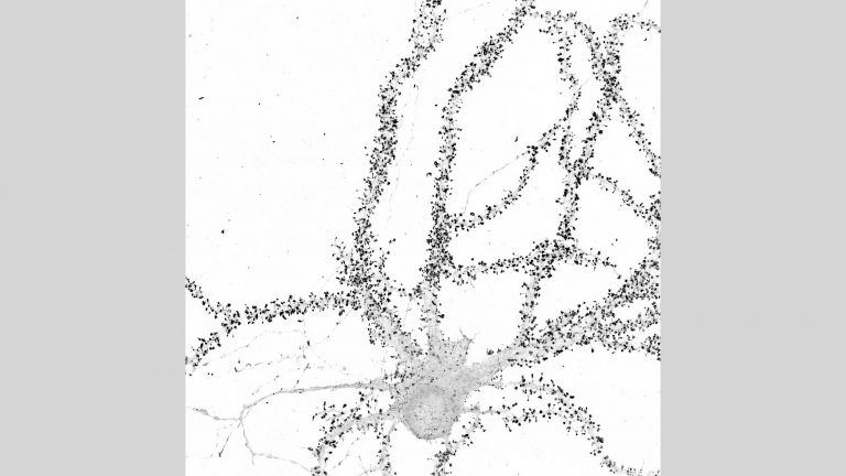 Verfolgung der Echtzeit-Dynamik der Protein-Synthese für endogene Proteine in lebenden Neuronen. Gezeigt: Superauflösendes Airyscan-Bild des endogenen synaptischen Proteins CAMK2a.