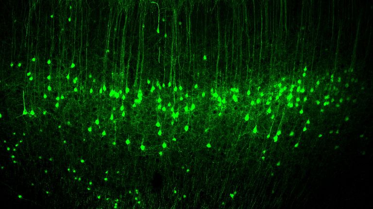 Neurone aus der Layer 5 des motorischen Kortex, die mit einem Fluoreszenzfarbstoff angefärbt wurden.