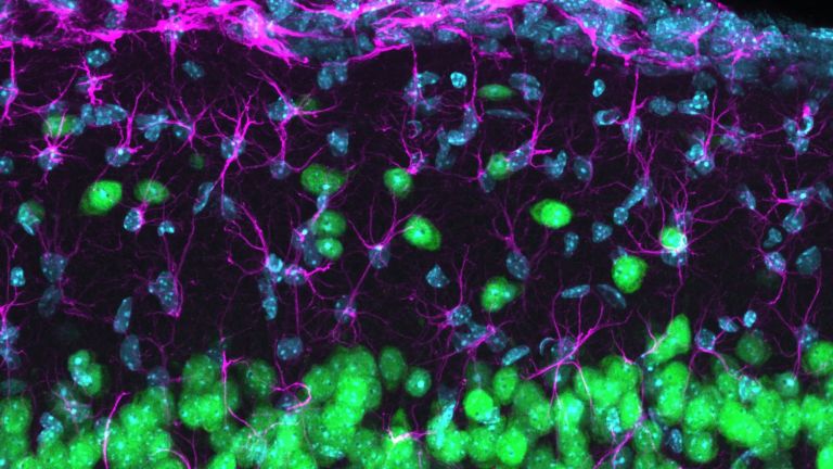 Fluoreszenzmikroskopische Aufnahme der kortikalen Schicht 1, die die zelluläre Architektur dieser äußersten kortikalen Schicht hervorhebt. Zellkerne sind in Cyan, Astrozyten in Magenta und Neuronen in Grün dargestellt.
